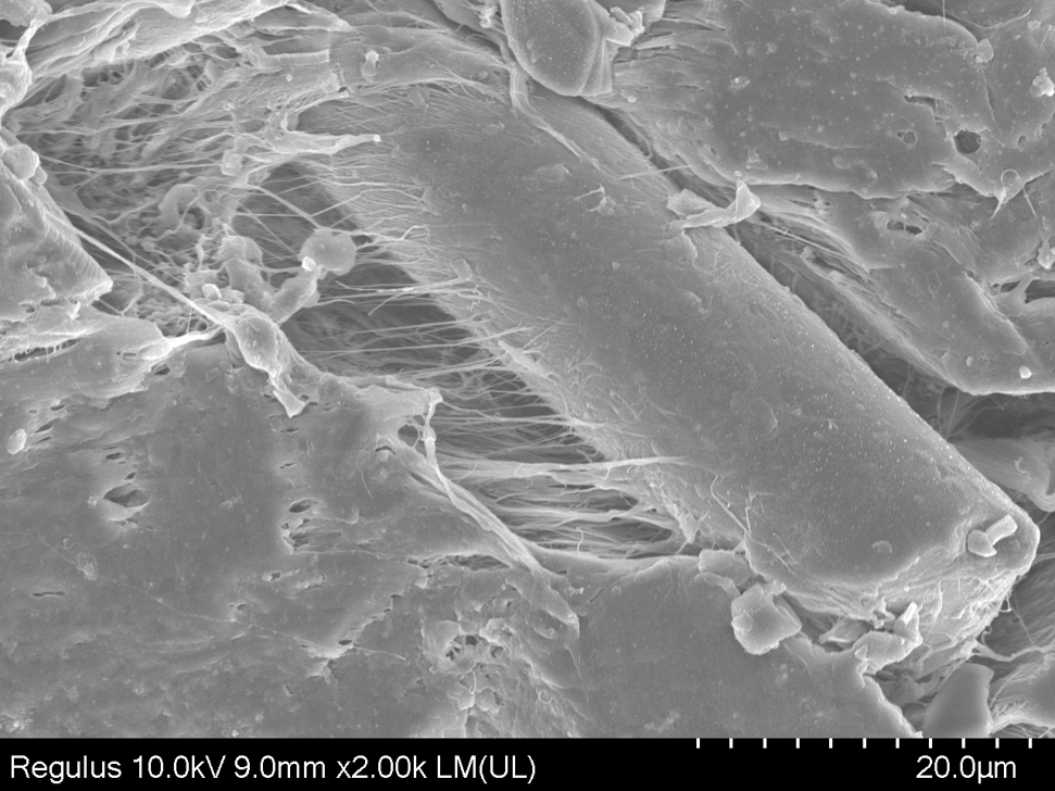【黄瓜视频下载APP视频】掃描電鏡SEM觀察黄瓜视频污在线观看機處理後的材料